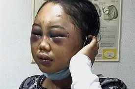 Tenaganita's tweet photo. International Day in Remembrance of Victims of Torture! Adelina Lisao, Nirmala Bonat,Siami, Siti Hajar,Mey Sichan, , Isti Komariyah,Mariance Kabu,Suyanti Sutrinso, and many more DWs  tortured in Malaysia.
We need a new law for Domestic Workers.
#EndTortureNow 
#DontLookAway https://t.co/op150GXN2u