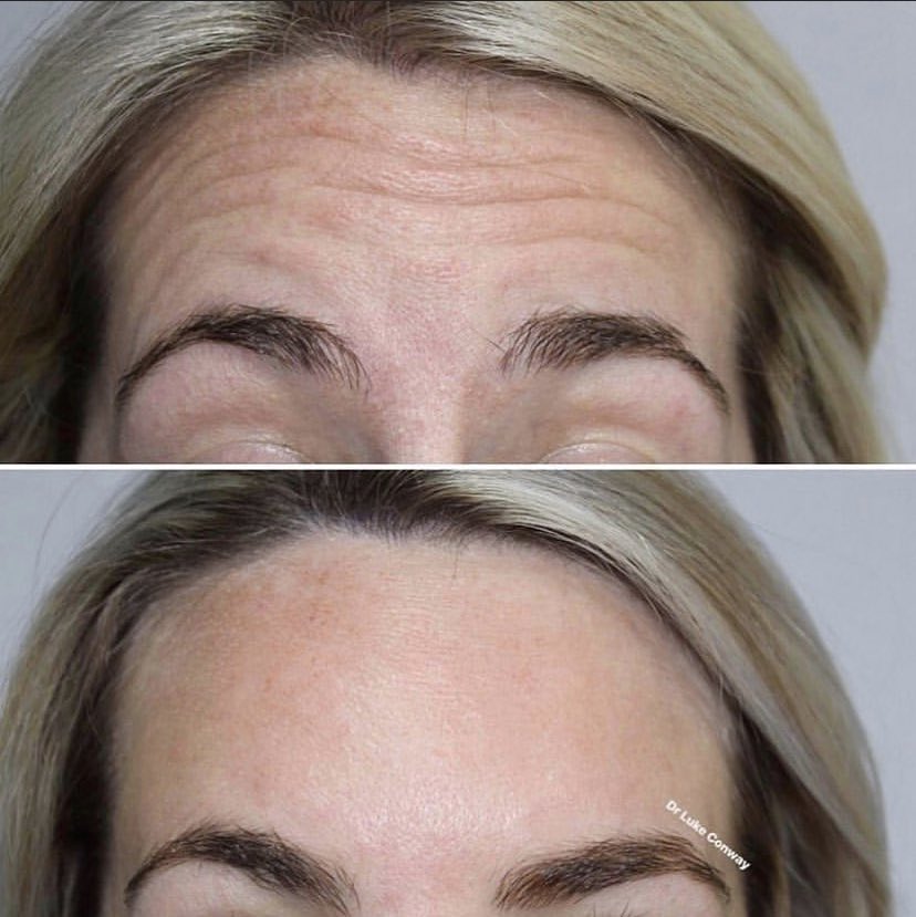 Our aesthetics clinic is back!!! 😆🎉 Appointments now being taken!! 
<a href="/doctor/">Doctor.com, a Press Ganey Solution</a>.conway is an advanced aesthetics practitioner specialising in botox, dermal filler &amp; rhinoplasty techniques
Appointments dates at the spa.... 
Sun 11th July &amp; Sunday 18th July 
info@chilloutspa.co.uk