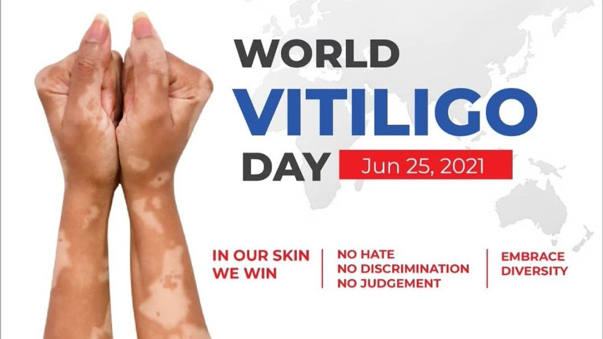 tatveda's tweet image. सफ़ेद दाग ना संक्रमण है ना अभिशाप, भेदभाव ना करो इनसे रखो प्रेम और मानवता का भाव। #vitiligo का इलाज सम्भव है। डॉ एच एस चौहान #dermatologist त्वचा क्लिनिक 9012548090  #leukoderma #VitiligoDay #WorldVitiligoDay twachadermatologyclinic.com #Meerut #Bijnor #Najibabad #Noorpur #india
