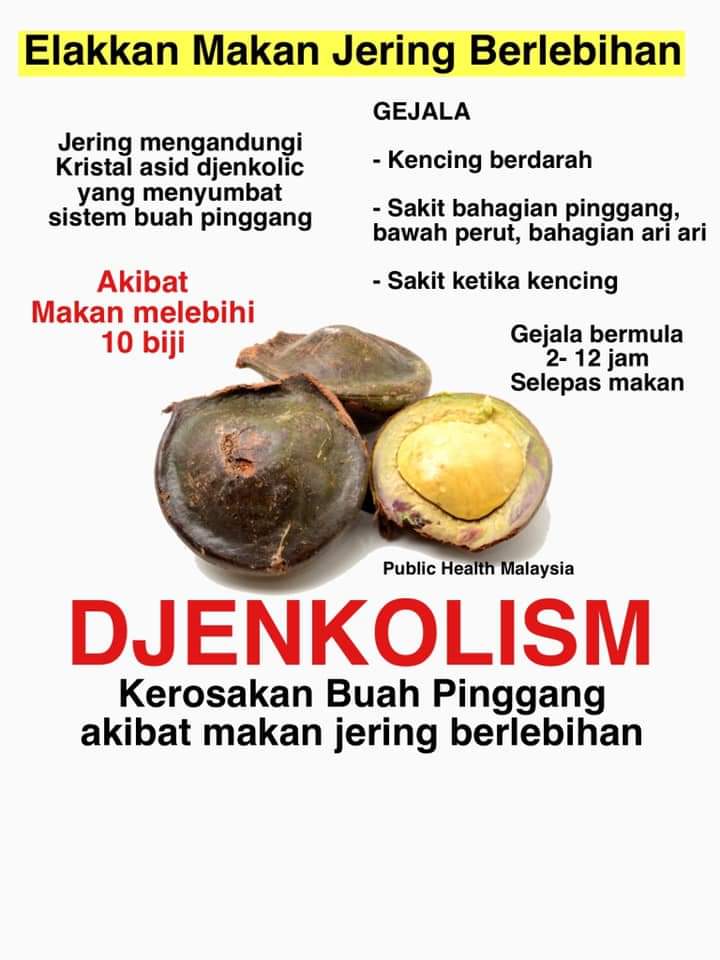 Public Health Malaysia On Twitter Seorang Lelaki Dikejarkan Ke Hospital Selepas Mengadu Kesakitan Dibahagian Pinggang Dengan Kesukaran Untuk Kencing Lelaki Berusia 32 Tahun Ini Meraung Raung Kesakitan Beserta Muntah Dan Lesu Tiub