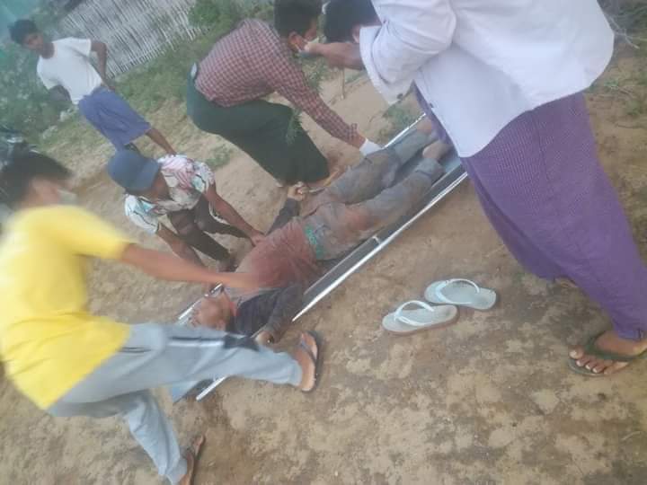 TW // Death
At around 8 pm on July 8, Junta terrorists unwarrantedly shot and killed Ko Phyo Hlaing Win, a young man riding a motorcycle, in #Myingyan. He was from Sakha Sha village, west of industrial zone. His body was retrieved by the public on the morning of July 9
#July9Coup