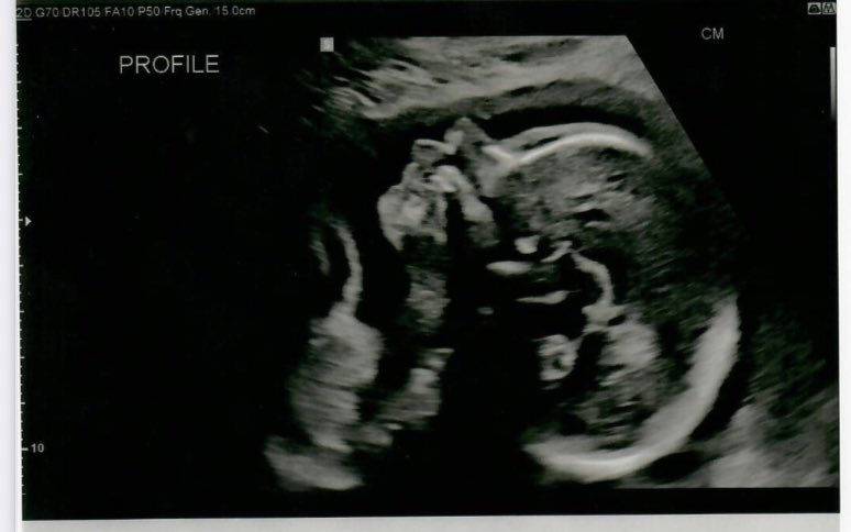 dayna_c_ramos's tweet photo. 24 weeks with my angel baby.🤍 https://t.co/rgvqkqFyi5