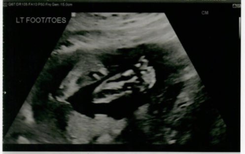 dayna_c_ramos's tweet photo. 24 weeks with my angel baby.🤍 https://t.co/rgvqkqFyi5