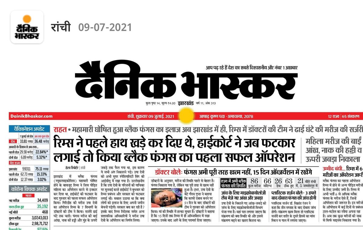 ankitshukla1979's tweet photo. ब्लैक फंगस से निजात के लिए उषा देवी की बाई आंख, नाक की हड्डी व ऊपरी जबड़ा निकालना पड़ा. रिम्स ने समय पर ऑपरेशन किया होता तो शायद कम नुकसान में बात बन जाती. इलाज में देरी की जांच होनी चाहिए. #orderinquiry #RIIMS @babulalsharma19 @Ani1mesh @DuttaAnand @Kartikoffical @itssuniltiwari https://t.co/oCh4lqG2Zp