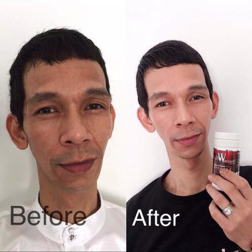 awesomejdk1's tweet photo. PENGGUNA TEGAR KOREAN WHITENING TRIPLE C… HASIL SELEPAS 2 BULAN PENGUNAAN 😍😍.. DM UNTUK KULIT FLAWLESS&amp; PUTIH GEBU.. https://t.co/p0ucIfT61u