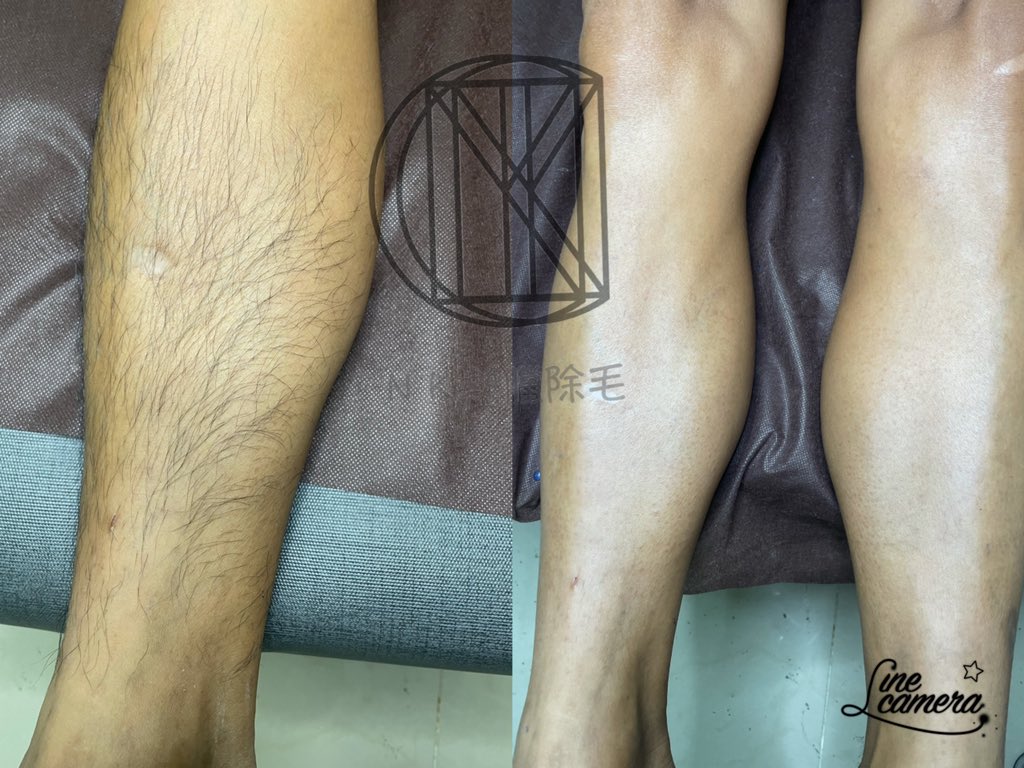 Nick男士熱臘除毛 (@nick13951233) on Twitter photo 