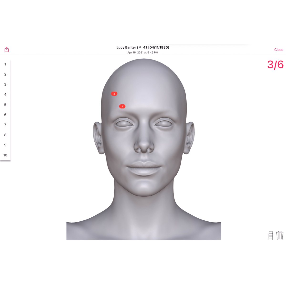 EZDERM's tweet photo. Fill her up! Apply Botox &amp; filler directly onto a photo of the patient or the avatar. https://t.co/BFJNcDep2d