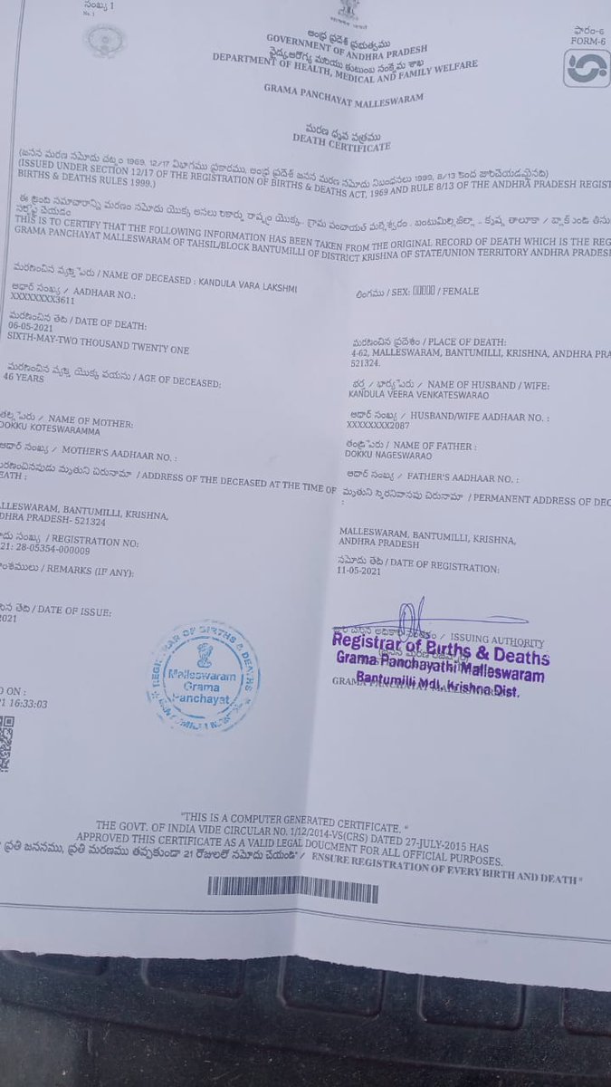 Ponnamv69992455's tweet photo. My Friend Kandula Prem Sai, Age 29 years suffering from BLACK FUNGUS.Both his father and mother expired due to COVID in the month of May 5th and 6th.After 10days of their death he was also effected with COVID admitted at  Help hospitals,Vijayawada,Andhra Pradesh and recovered. https://t.co/qJEp1GGnDw