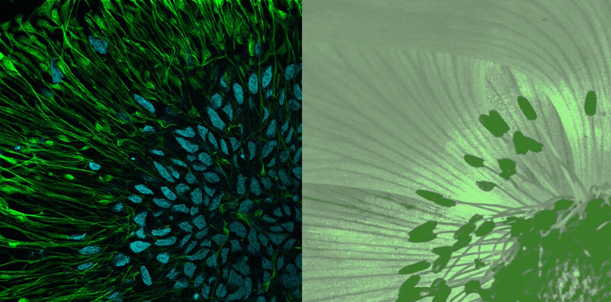 GSTTresearch's tweet photo. As part of yesterday's #KHPSummerSchool2021 lesson with @KCLstemcells, our students were asked to take part in the fantastic #Recreatescience activity.
Here our students have recreated images of developing neurons, and two neural rosettes.
Find out more:https://t.co/yLnGn0amY1 https://t.co/3PuWqa5ROO