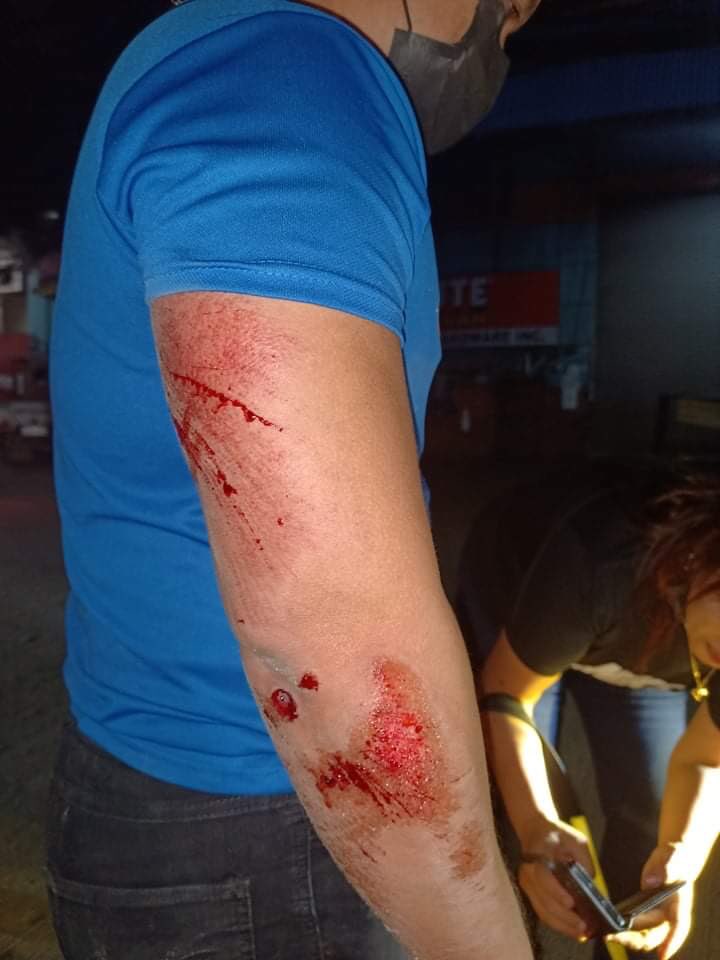 gasgas sa motor