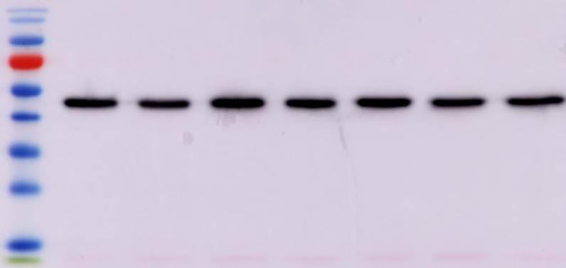 ilyas_alav's tweet photo. I have finally managed to blot my proteins and have the most beautiful blot to prove it. I'm definitely framing this one. 😍 https://t.co/5KnmalQN43