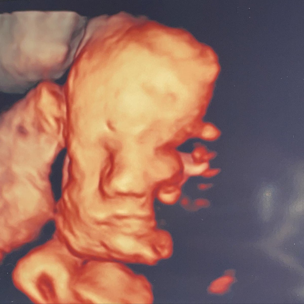 vichowsonRN's tweet photo. Can’t wait to meet you baby 🤍✨ 

#29weeks #babyhart #septemberbaby https://t.co/RGGirSvZeV