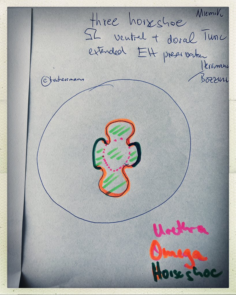 <a href="/proflutfitunc/">Prof. Dr. Lütfi Tunç</a> the difference between #usAEEP and “three horseshoe” <a href="/a_miernik/">Arkadiusz Miernik</a> or “complete mucosal arch” #Gomezsancha and #ejac template of #bozzini  / #trwherrmann or #omega #tunc template is as I !tried! to draw - please excuse, I have hired an illustrator <a href="/AeepThe/">AEEP-Team</a>