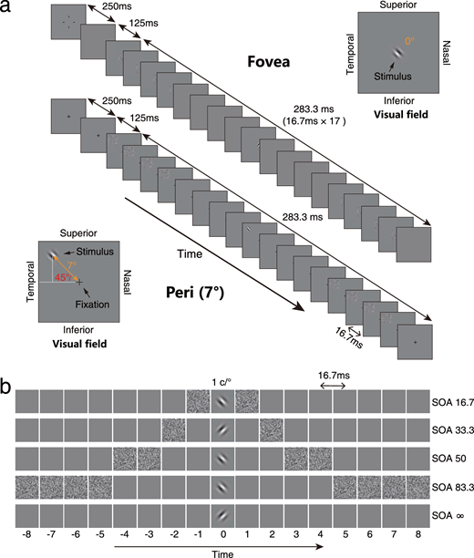 ARVOiovs's tweet image. A new study found high #myopia is associated with defective temporal processing in the #fovea, captured by a flattened temporal window. 

Read more in the free article: doi.org/10.1167/iovs.6… #VisualField #psychophysics #Vision #SpatialVision #OpenAccess #PerceptualTemplateModel