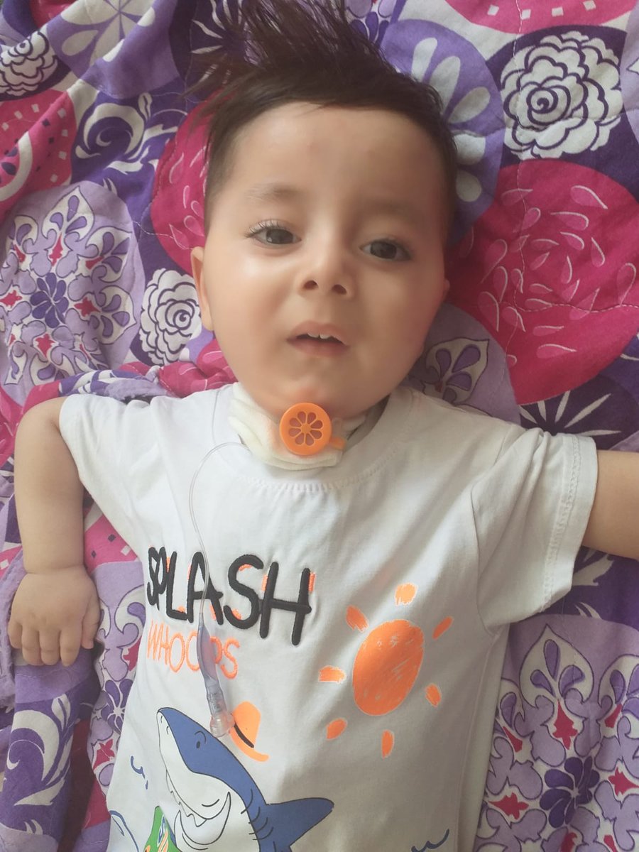 furkansmatip's tweet photo. Biz anne-baba olarak evladımız için sizlerden yardım bekliyoruz.Furkan, SMA'yı sizin desteğinizle yenebilir ancak. Ne olur sonra değil şimdi görün oğlumu.Gücü yeten bağış yapsın.Gücü yetmeyen bir paylaşımla sesimizi duyursun lütfen

Özlem Türeci #Sinovac Hakan Altun   gönül dağı https://t.co/z8k9GLpOV3