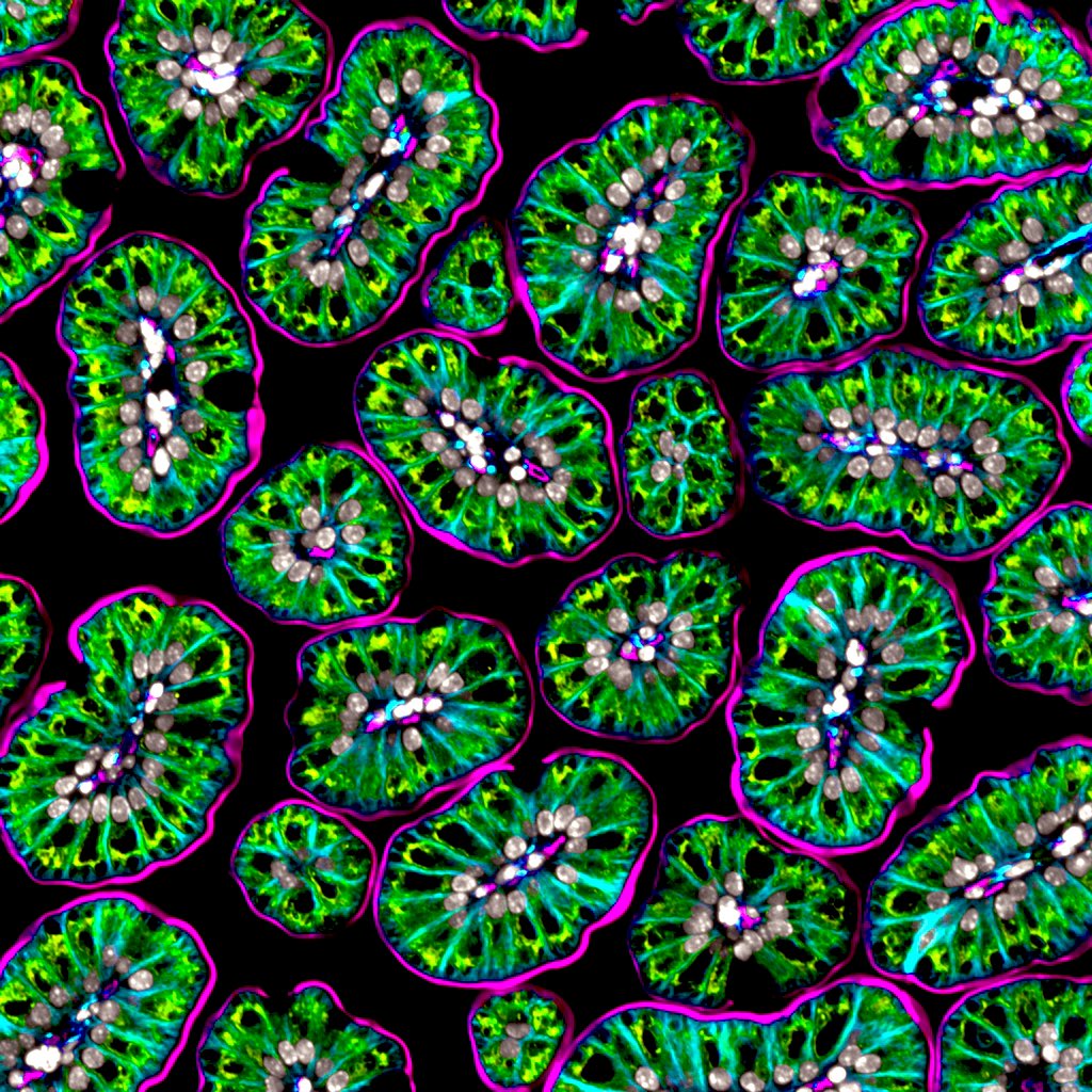Hello weekend! #FluorescenceFriday #Microscopy #bioart #sciart 🐭 intestinal villi stained for golgi in green, alpha tubulin in blue and phosphorylated Ezrin in purple 🔬