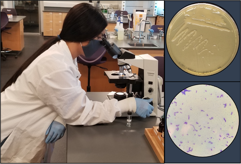 micro_clopez's tweet photo. Summer side-project identifying microbes from a wild-fermented apple cider @sacstate . Not sure what this one is yet, but it's pretty gooey on a plate. Cheers! #FermentedFriday https://t.co/znqAJD90L2