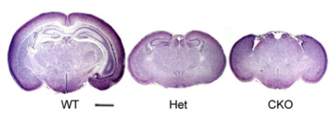 Zeynep Turan's thesis work is such wild food for thought. A characterization of life and behavior in fully cortex- and hippocampus-less Pals1 flox/flox x Emx1-Cre mice: thesis.library.caltech.edu/14263/2/Zeynep…