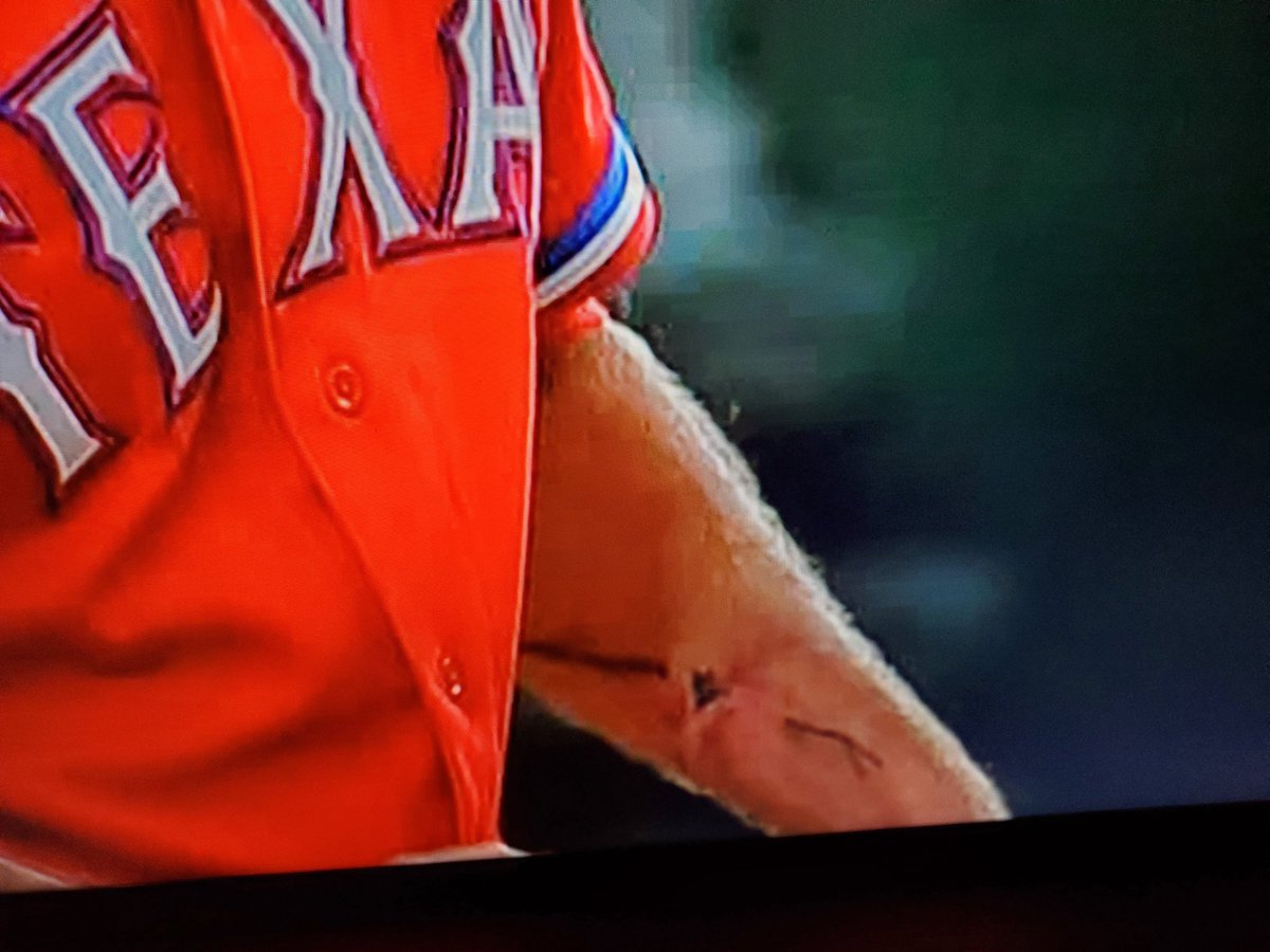 Watching <a href="/Rangers/">Texas Rangers</a> game. What's going on with Patton's arm <a href="/CJNitkowski/">CJ</a> ?