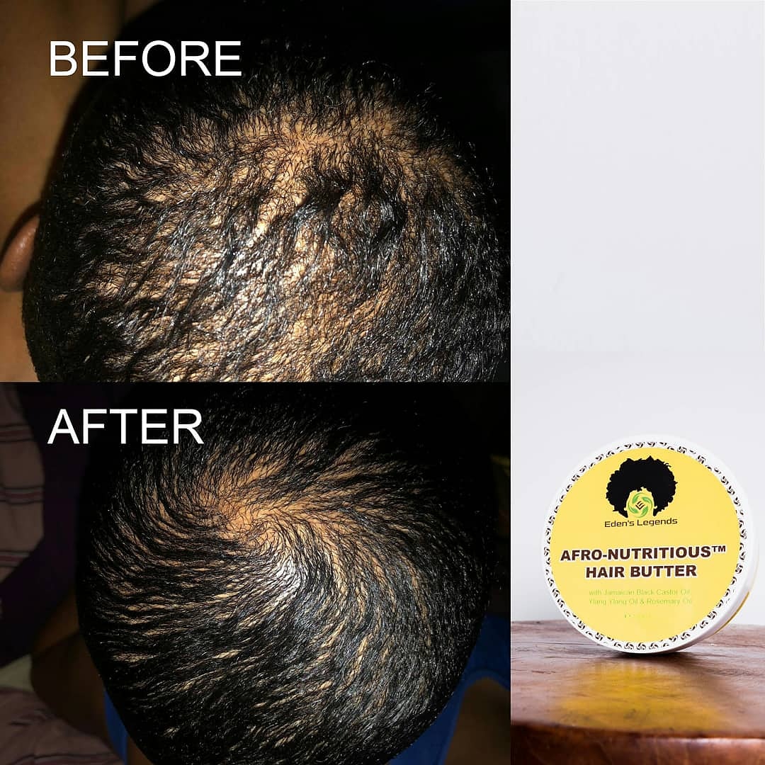 EdensLegends's tweet photo. Afro-Nutritious Hair Butter 💛
* Customer Review *
Visit https://t.co/JFbJ7s0dvG
to purchase yours.
#hairresult #hairbutter
#hairgrowth #recedinghair
#hairrepair #damagedhair
#haircare #chronicdryscalp https://t.co/pW3fduJkrd