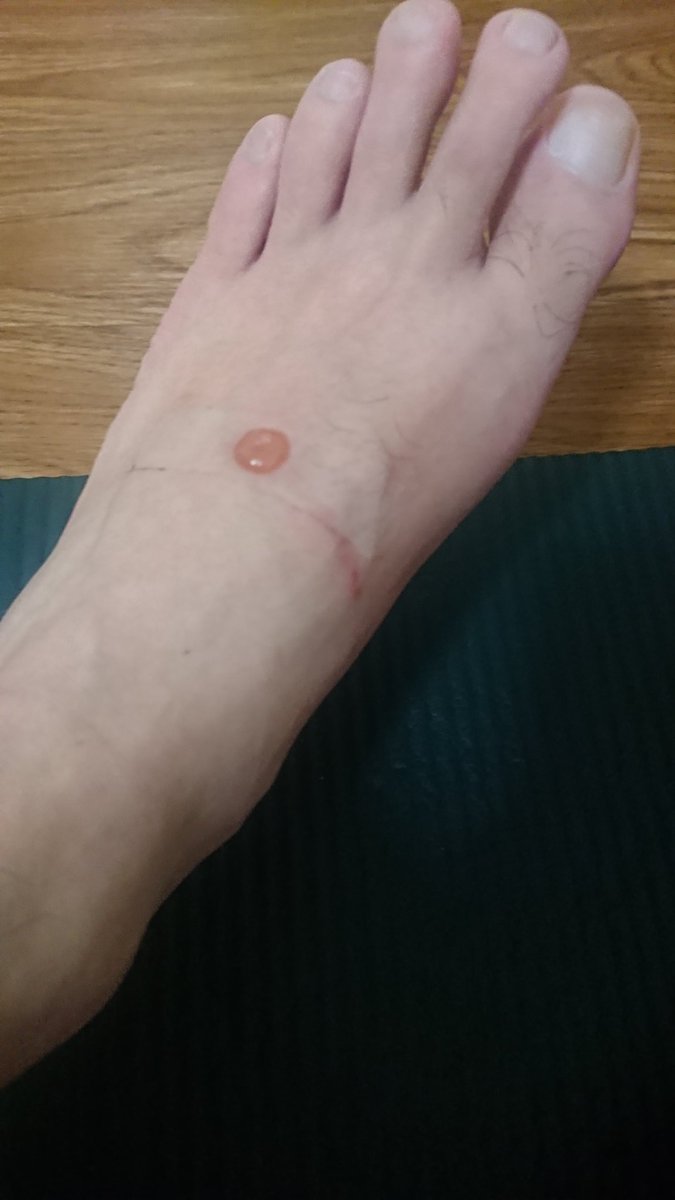 ぷっつん河島キレキレダンス ドラゴンボールの天津飯みたいに 額に第三の目が開眼する 三つ目族っていうのは 聞いたことあるんだが 今 俺の足の甲に 第三の乳首が誕生したんだが これは何族なんだ しかも足の甲って このままサッカーしたら 開発される