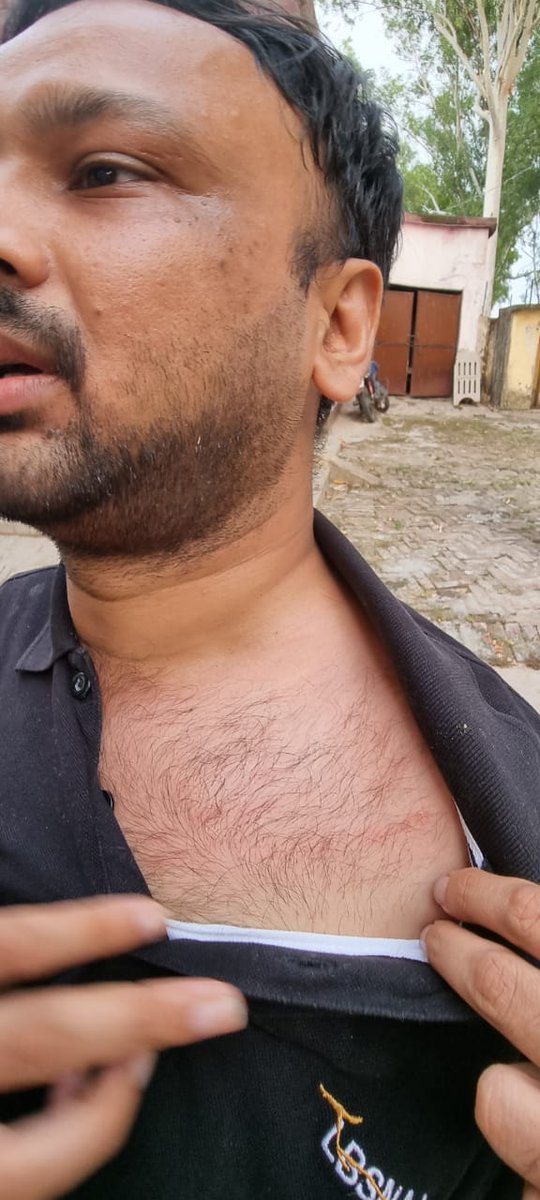 omendrasachan's tweet photo. @Amitabhthakur @UPGovt @unnaopolice @Uppolice @IASassociation This is what the so-called reported did earlier.. try knowing both side of the stories.. https://t.co/3UyZRp4h5t