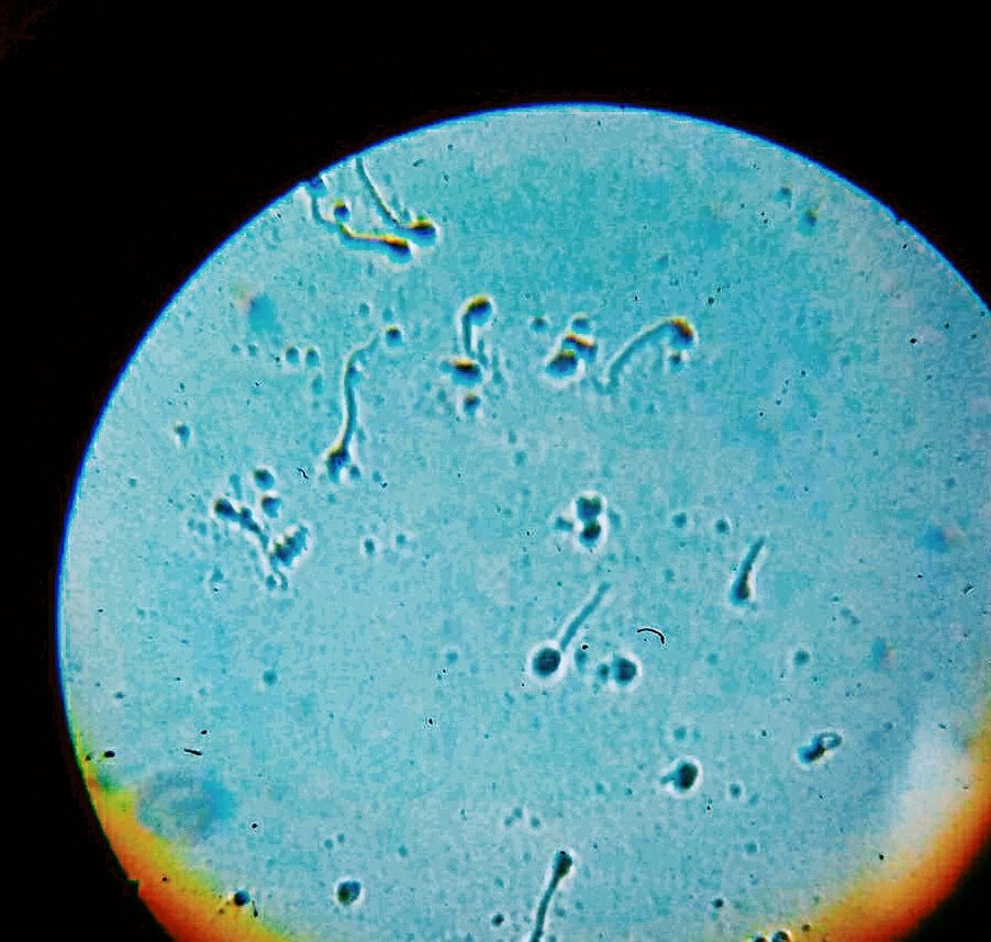 anjalimaru09's tweet photo. #nitrobluetetrazolium #spermatozoa #compoundmicroscope https://t.co/NLZasJqtv7