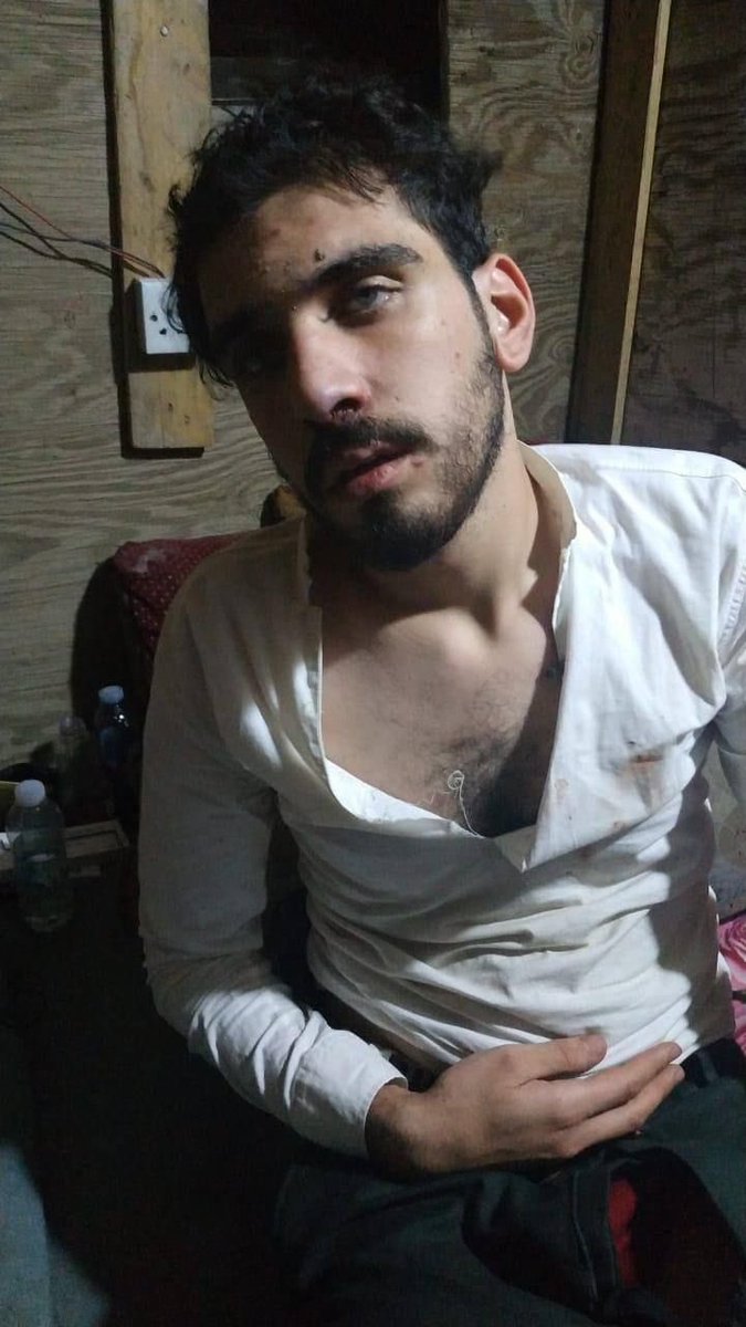 EAlobuidy's tweet photo. @ahmedalbasheer1 اثار التعذيب وتم نقله الى المشفى https://t.co/Ns1XMnODoS