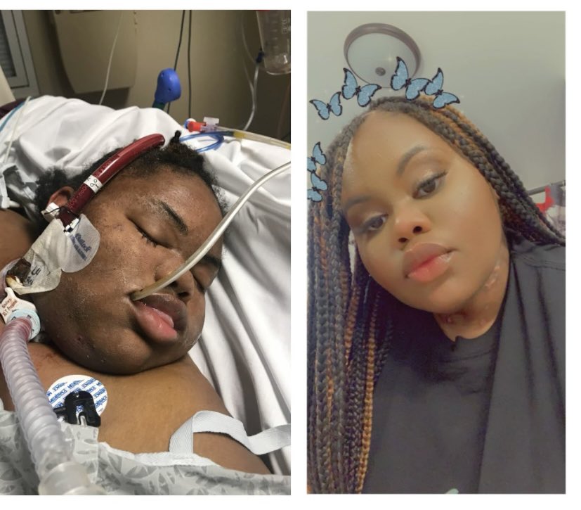 OhSoYouTan__'s tweet photo. To God be the Glory for ALL the things that HE has done 🙌🏽. I spent 97 days in the hospital fighting for my life because of Covid. Many days it looked like I wouldn’t make it ! BUT GOD 🙌🏽 As my favorite song writer Rich Tolbert wrote “I’m alive because there’s more #Tannerstrong https://t.co/q5yaLTr5nJ