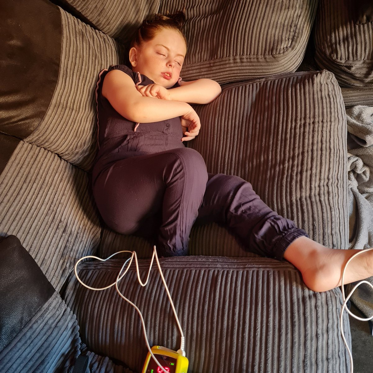 HannahMeIDD8P's tweet photo. And the clock resets.
In epic style. 5 tonic clonics in 8 hours resulting in a big dose of rescue meds.
Here's hoping her Gastrostomy surgery can still go ahead tomorrow. 💔
#Epilepsy #InvDuDel8p #SCN1B #RareGeneticEpilepsy #GEFS+
#WonkyGenes #Seizure #TonicClonic https://t.co/cbzvtBPWQe