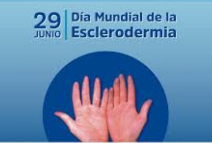 #Efeméride | #29Jun Día Mundial contra la Esclerodermia, se conmemora el fallecimiento del pintor Paul Klee quien la padeció. La esclerodermia, esclerosis sistémica o “piel dura”, es una enfermedad autoinmune que afecta sobre todo a la piel.
#GNBApure
#LiberenALosPatriotas