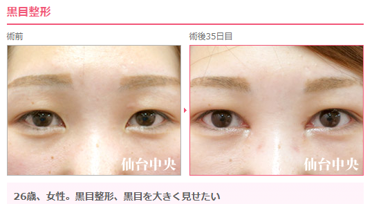 黒目を大きくする Twitter Search Twitter