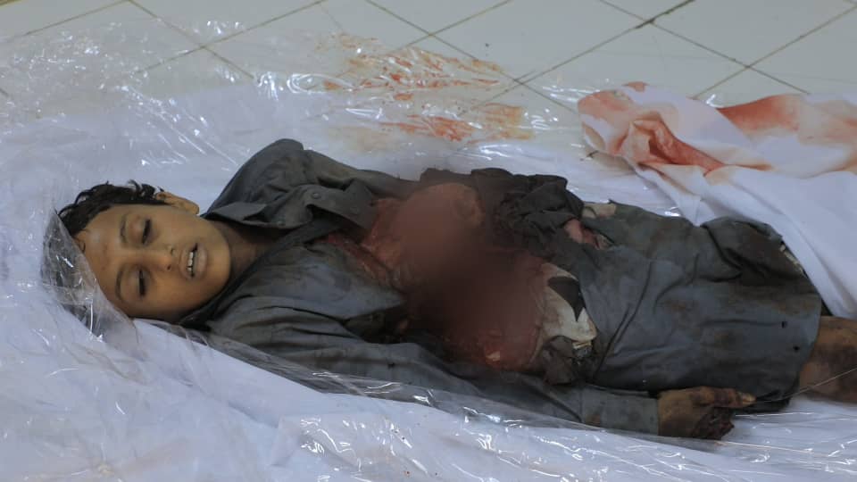 Marib_gov's tweet photo. استشهد 3 مدنيين بينهم طفل وأصيب 10 آخرون بينهم 3 أطفال اليوم الثلاثاء بشظايا صاروخ بالستي أطلقته مليشيات الحوثي الارهابية التابعة لإيران على حي سكني بمدينة #مأرب.
#Marib
#Yemeb https://t.co/aag7fZ5VSO