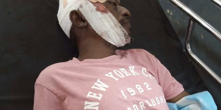 BigDaddyCee7's tweet photo. If You Are A Patriotic Citizen Of Ghana n Becus Of Politics n Favouritism n U Can't Talk Against n Still Support Dis Killing Of Dis Innocent Guys Who Were Expressing Their Civil Rights n Demonstrating,Then Ur A Coward,Dudubansa n Jon
#RestInPeaceGuys😭😭😭😭 https://t.co/95X9o5iqqc
