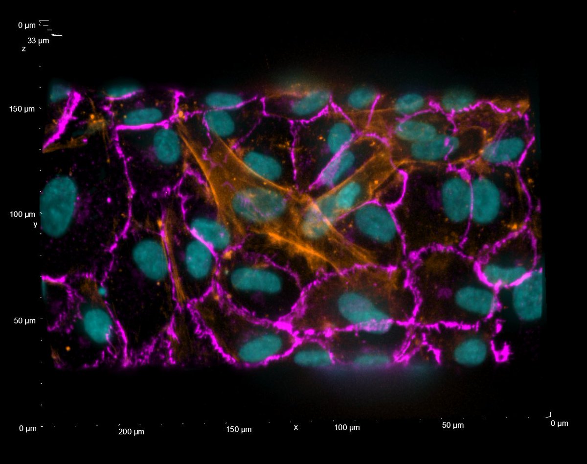 I was doing some microscopy and I remembered I wanted to share this beautiful picture of #pericytes on top of #brain #EndothelialCells channel! 

#OrgansOnChip