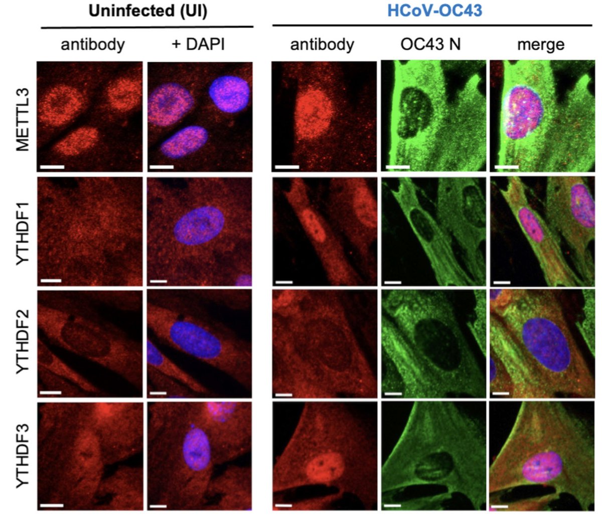 Genes & Development (@genesdev) on Twitter photo Here, Burgess et al. show that replication of SARS-CoV-2 & HCoV-OC43, can be suppressed by depletion of nuclear RNA methyltransferase METTL3 or cytoplasmic m6A readers YTHDF1 & YTHDF3 & by a small molecule METTL3 inhibitor.
<a href="/HannahmBurgess/">Dr Hannah Burgess</a> @DanDepledge
genesdev.cshlp.org/content/early/… Here, Burgess et al. show that replication of SARS-CoV-2 & HCoV-OC43, can be suppressed by depletion of nuclear RNA methyltransferase METTL3 or cytoplasmic m6A readers YTHDF1 & YTHDF3 & by a small molecule METTL3 inhibitor.
<a href="/HannahmBurgess/">Dr Hannah Burgess</a> @DanDepledge
genesdev.cshlp.org/content/early/…
