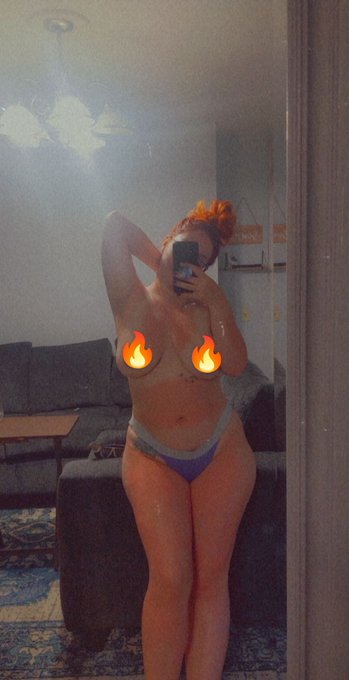 I used flame emojis because my whole body is sunburnt and feels like I'm on fire 😩🥺🥲 https://t.co/un