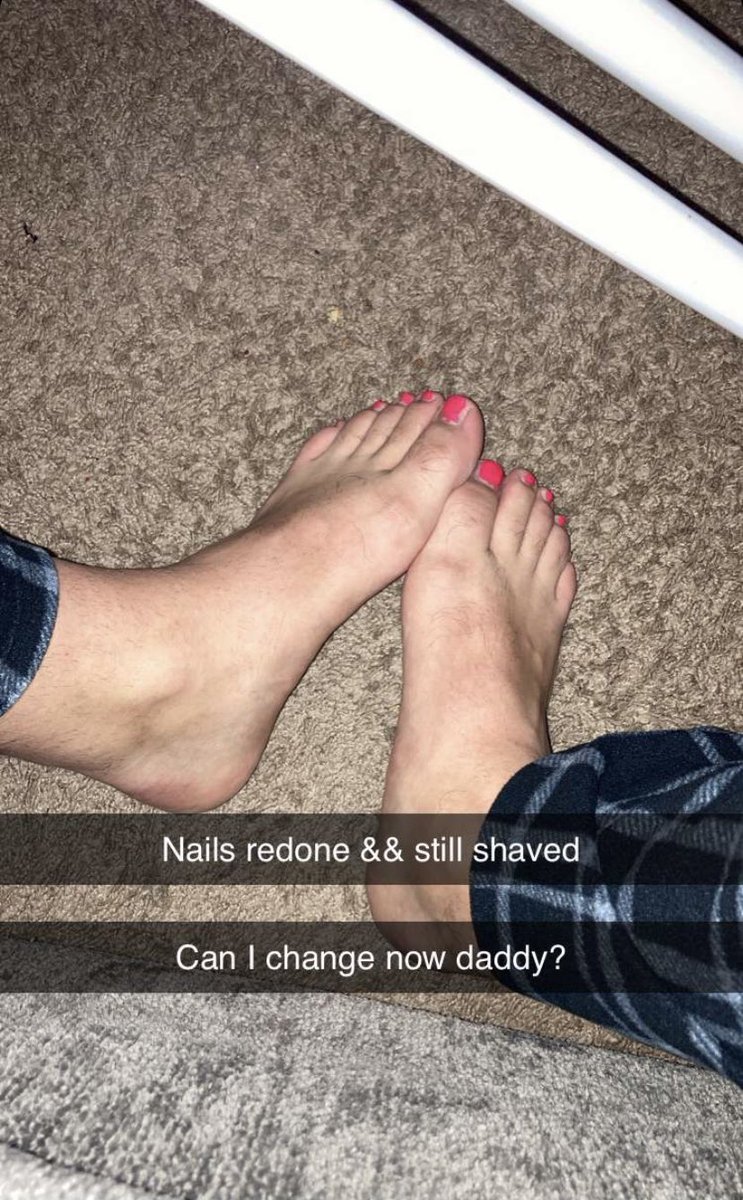 MathewThompso's tweet photo. Her toes still look horrendous but I guess it’s an improvement from yesterday #sissy #humiliateme #mathewthompson #clarksville #Tennessee #comevisitme #wilmawalmart https://t.co/cyryzwuzX2