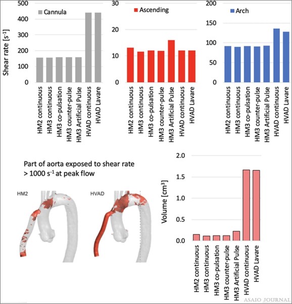 asaiojournal's tweet image. Read the #FREE July issue Editors Pick!
Left Ventricular Assist Device Flow Pattern Analysis Using a Novel Model Incorporating Left Ventricular Pulsatility
ow.ly/8Ja150Fl9gr
@JonGrinstein @hect2701

#LVAD #Pulsatility #ComputationalFluidDynamics