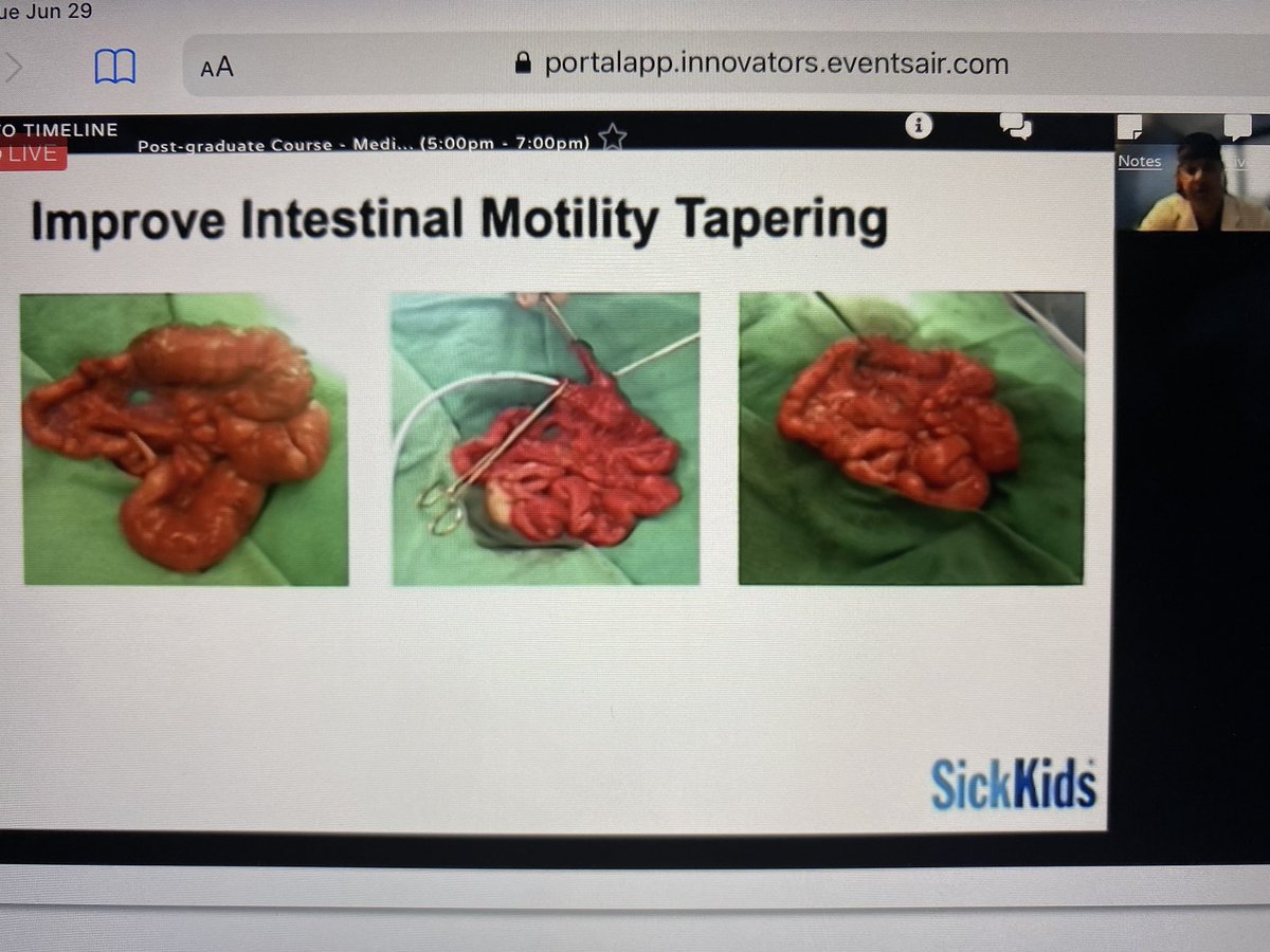 PifrsP's tweet photo. @2021Cirta underway with @paulwalesGIFT and colleagues presenting during the medical/surgical pre symposium! - virtual learning continues @LiftEcho @UofTGastroHep  #intestine #remotelearning @CHPtransplant @CarlosOEsquivel https://t.co/3d2RPmSRXl