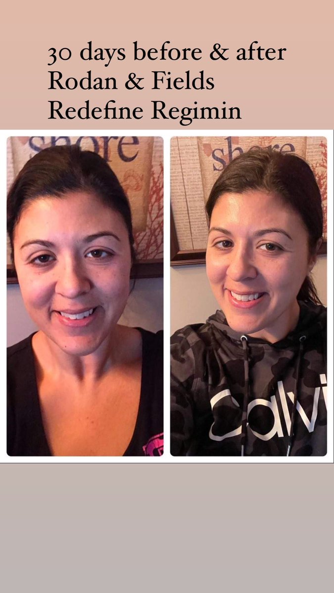 peg8123's tweet photo. #redefine #rodanandfields #askme #consulant https://t.co/fMCqAdXeIW https://t.co/XeiETPLCqq