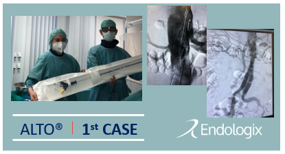 endologix's tweet photo. We congratulate Associated Prof Andrej Schmidt and Dr. Daniela Branzan, university Leipzig, for their first #ALTO case in Germany.  The case had successful treatment of complex AAA-hostile neck with very narrow access and high angulated iliac. #EVARevolved https://t.co/GhIGJ6LZqq
