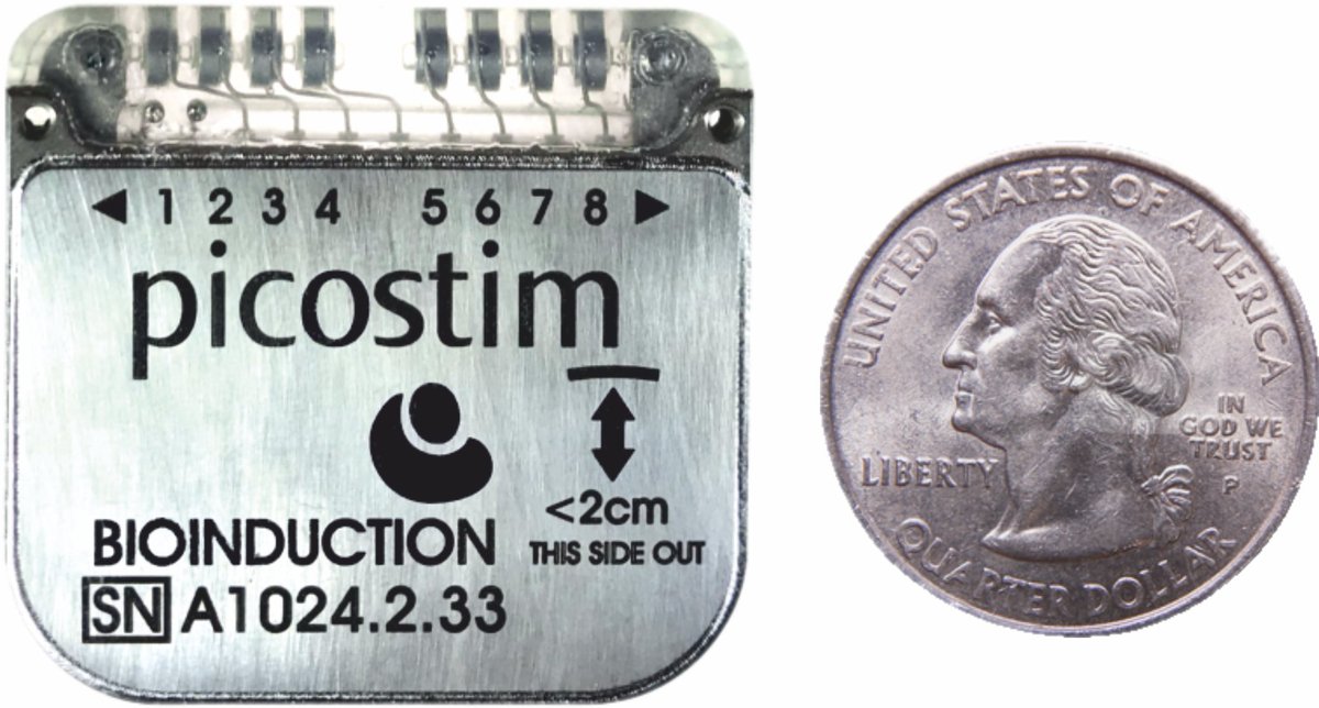 neuromodulate's tweet photo. 🙌@Bioinduction Announces World's 1st Implantations of 'PICOSTIM', a Novel, Less Invasive, #Cranialized 'Brain Pacemaker' for #Parkinsons Disease
https://t.co/BqFe8GKBDb
#singlestage #DBS #Parkinsons #neuromodulation
@DBSThinkTank @stimbrains
@AshSharan @DoctorAliRezai https://t.co/cpF8J8O468