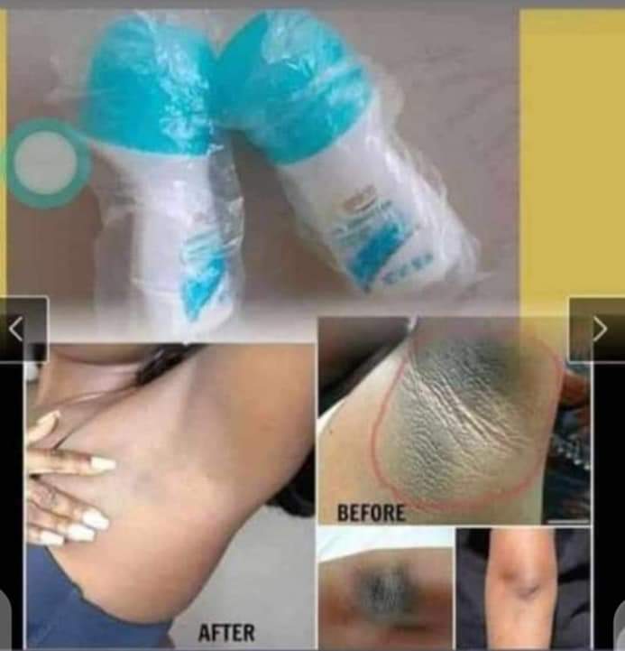 Dark Armpits-------------

Do you know anyone that has it?
Would you love to help the person get it cleared?

If yes, then reach out to me, you will be amazed at the result.

#AmazingProduct
#WeWorkWhatWorks
