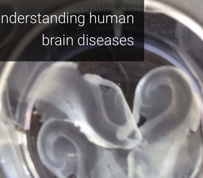 📢 Postdocts of the world! Where are you? We are looking for you! Neuropixels, miniscopes, optogenetics, single-cell recording and machine learning + computational models. All applied to understand hippocampal oscillations in health &amp; disease hippo-circuitlab.es