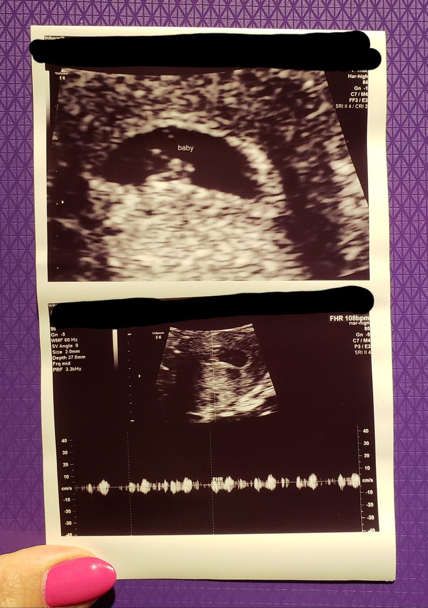 HappyCupcake67's tweet photo. Its happening! I couldn't be happier! No #infosecbikini  bc of obvious reasons but how about #infosecbaby ?  @3dchristech
#ItsHappening #BabyLoading #Loading #Techbaby #Family #Baby #Preggo #ParentsToBe  #JuinorIT #Player3 #AchievementUnlocked https://t.co/zCI5krubtW