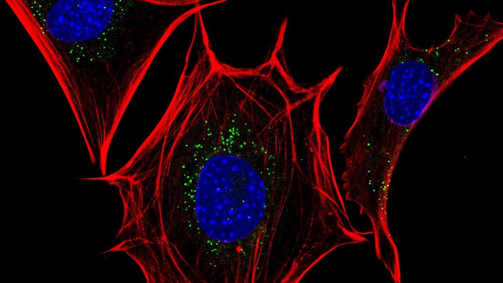 CSIC's tweet photo. 🔬La interacción entre dos proteínas celulares, posible diana frente al #cáncer

Un equipo del CSIC halla una ruta por la que la interrelación entre las proteínas Ras, asociadas a la generación del cáncer, y las Sos altera los mecanismos celulares

➡️https://t.co/Ez7auH4zNB https://t.co/nnpHuZuH7L