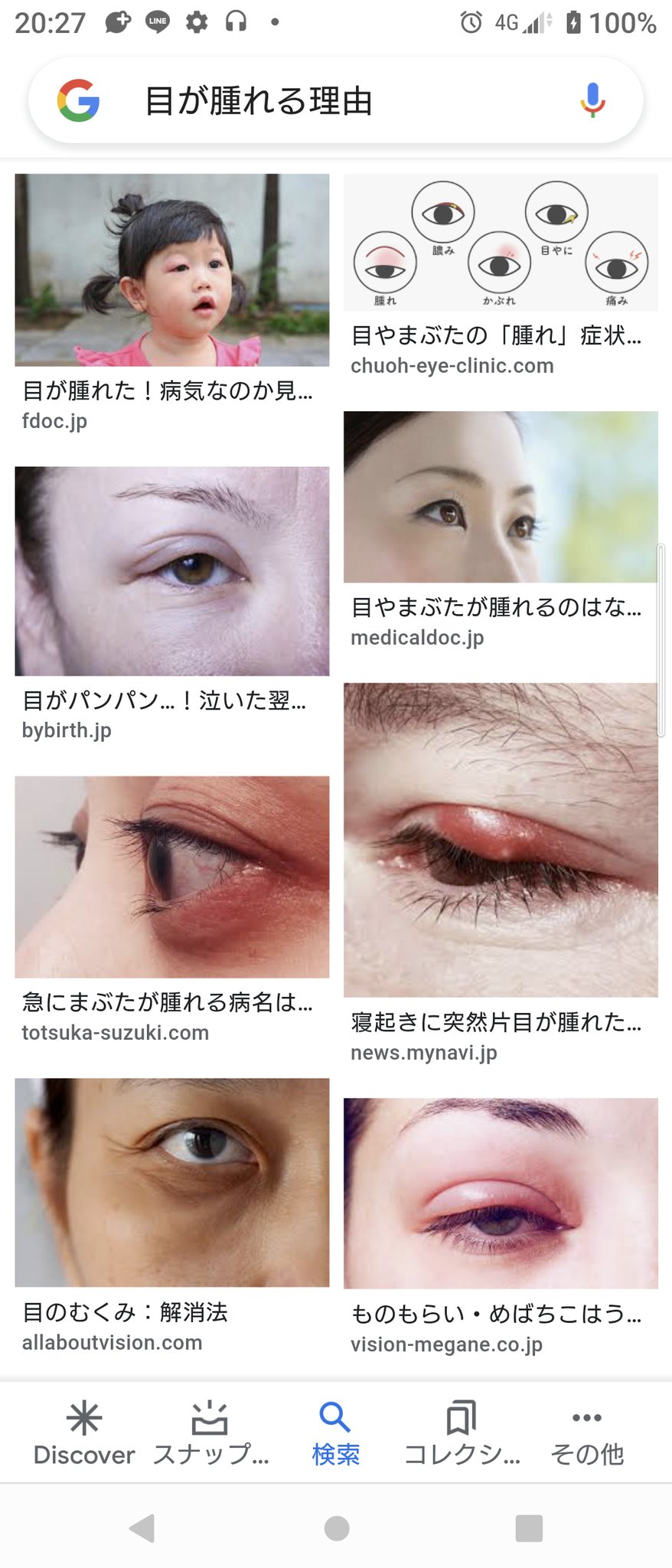 目が腫れる Twitter Search Twitter