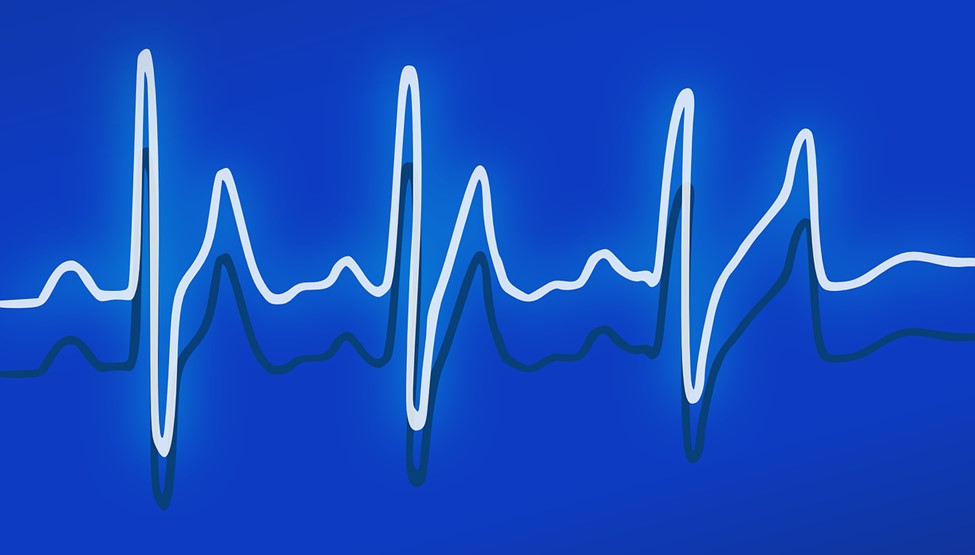 LESA_erc's tweet photo. Bio-Signal Sensing Improves Continuous Monitoring for Better Health Outcomes #systemsthatthink #biosensing #humanhealth #wellbeing #humanfactors #rpi  https://t.co/Q0W3MOzwhU https://t.co/Wlp94Re6CS