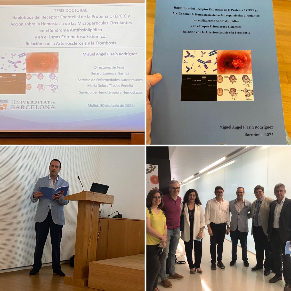 Hoy <a href="/slasyn/">Miguel Angel Plasin</a> ya es Doctor, muchas felicidades!!!! <a href="/MAS_Clinic/">Autoinmunes-Clínic</a> <a href="/hospitalclinic/">Hospital Clínic</a> <a href="/UniBarcelona/">Universitat de Barcelona</a>